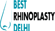 Best Rhinoplasty Delhi