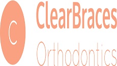 Clear Braces Orthodontics