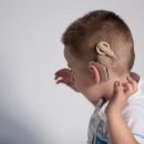Cochlear Implant Price in India