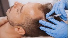 DHI Hair Implantation in Dubai