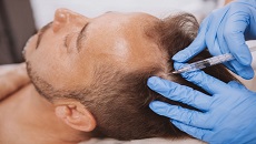Dubai's Premier FUE Hair Transplant Clinic: Where Miracles Happened