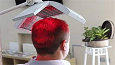 Laser Hair Therapy for Hair Loss in Dubai