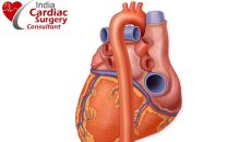 Low Cost Robotic Cardiac Surgery In India